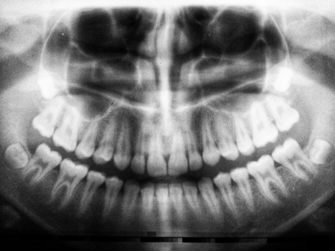 Radiografía panorámica dental
